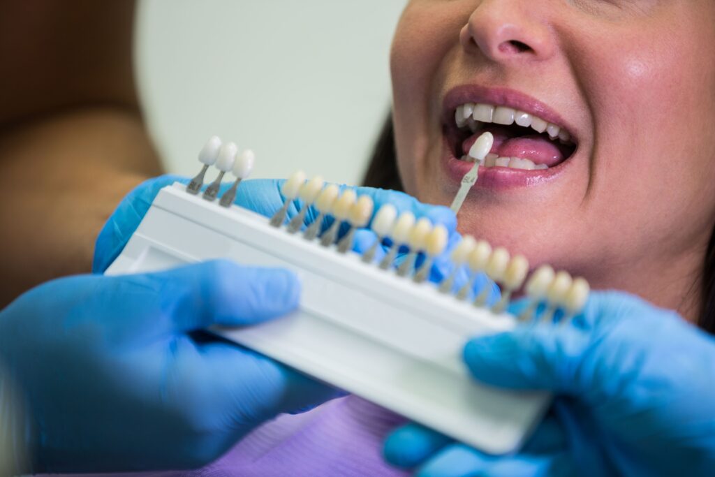 Blanqueamiento dental
